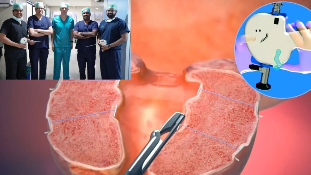 ainu urolift treatment